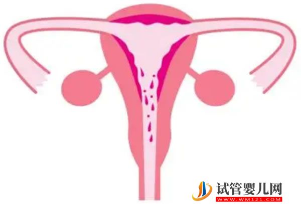 试管之窗 做试管婴儿要请假多久(图1)