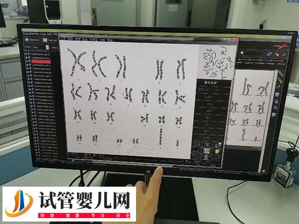 怀唐氏儿的原因有哪些(图1) 怀唐氏儿的原因有哪些(图1)