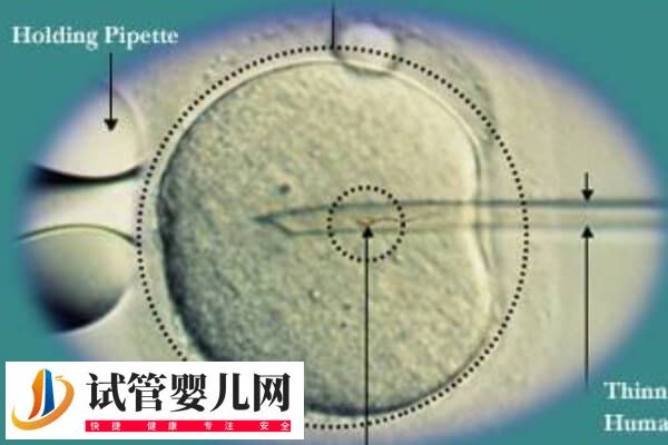 融合胚胎是不是连体婴儿(图2)