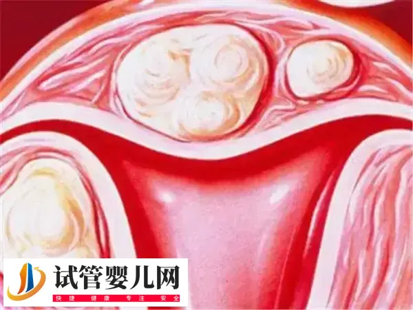 子宫内膜薄能不能做试管婴儿(图1) 子宫内膜薄能不能做试管婴儿(图1)