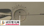 取12个卵配成2个胚胎正不正常