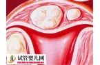 子宫内膜薄能不能做试管婴儿