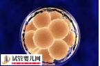 囊胚3bb移植的成功率多少