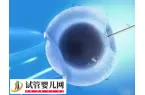 江苏妇幼院保健院做试管婴儿流程是怎么样的