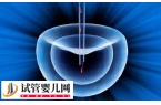 一代试管会把畸形精子删除挑出A级精子吗？