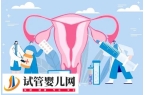 子宫内膜异位症做试管婴儿成功率高不高