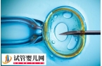 残角子宫做试管婴儿要注意什么